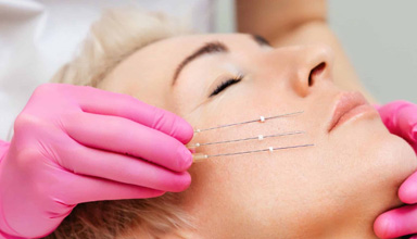 Threadlift