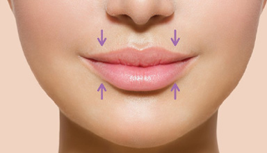 Lip Thinning and Lip Lift
