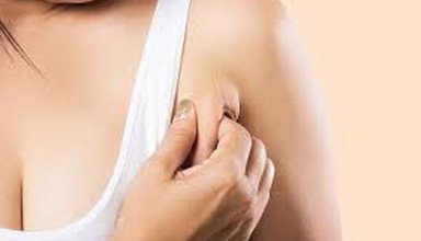 Axillary Breast Removal