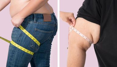 Arm and Thigh Liposuction