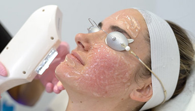 Photofacial