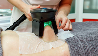 Cryolipolysis