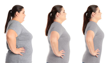 Massive Weight Loss Transformation