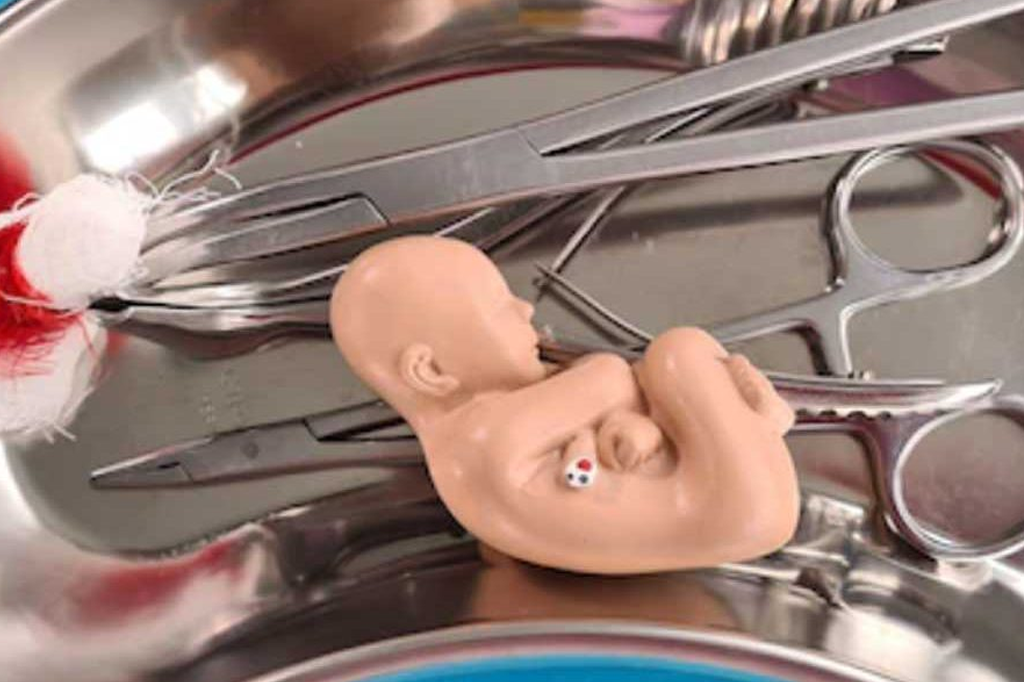 Surgical And Medical Abortion
