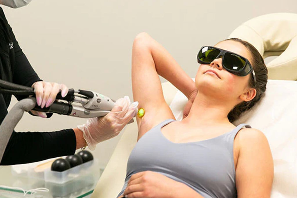 Laser Hair Removal