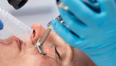 Laser Scar Reduction