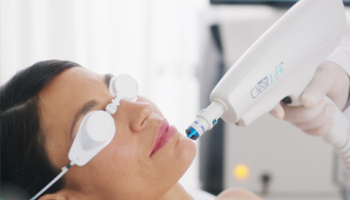 Clearlift Laser