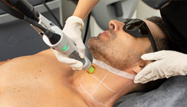 Laser Hair Removal