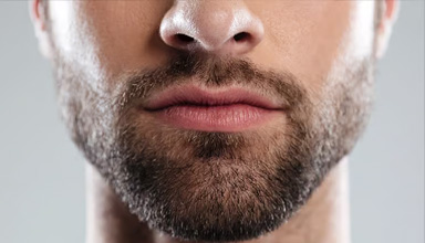 Moustache Transplant