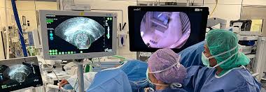 Understanding Uterine Fibroids: Symptoms, Diagnosis, and Treatment Options