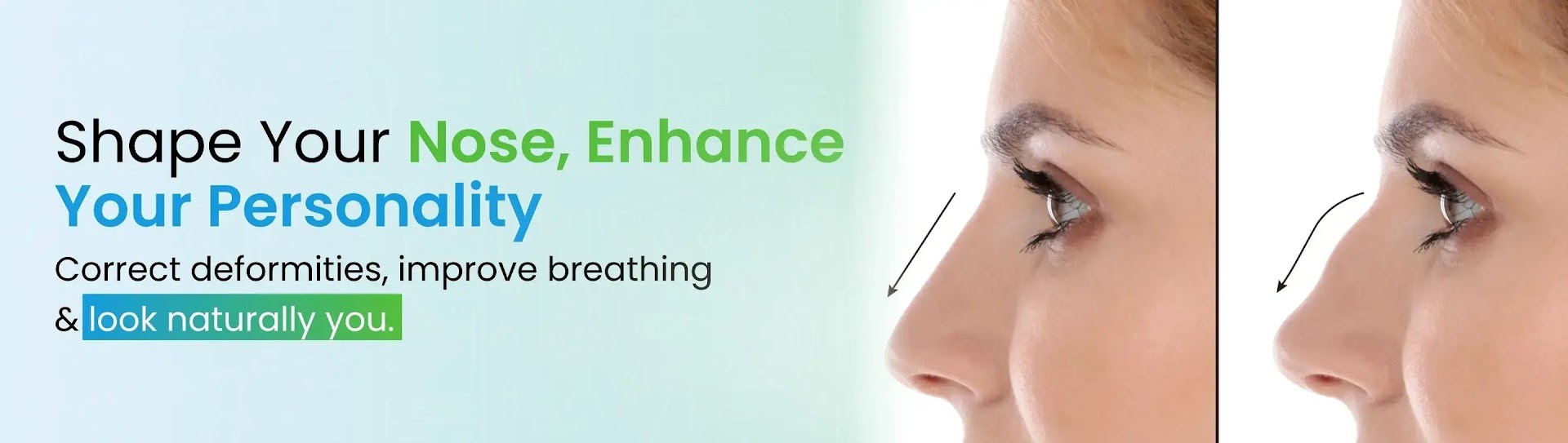 Rhinoplasty in Lucknow desktop banner image