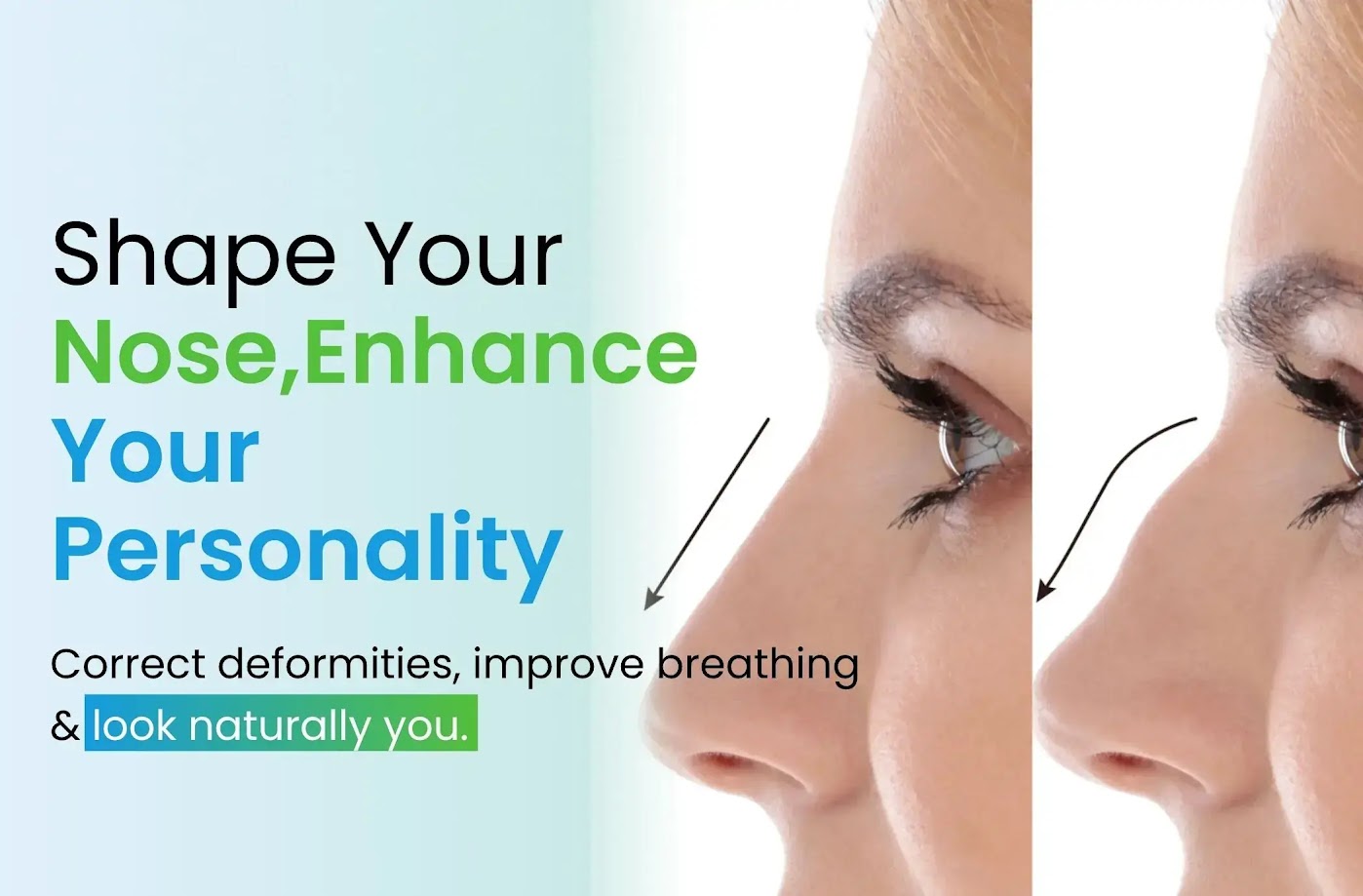 Rhinoplasty in Lucknow mobile banner image