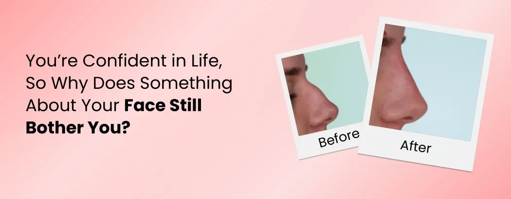 You’re Confident in Life, So Why Does Something About Your Face Still Bother You?