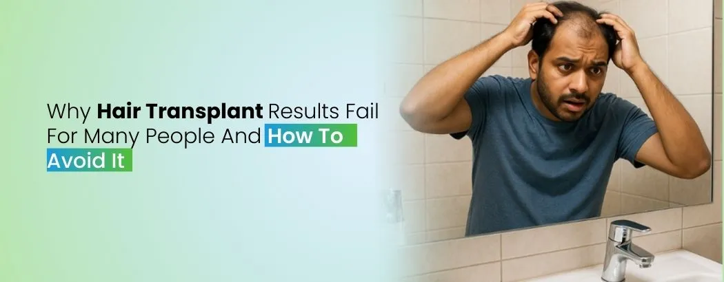 Why Hair Transplant Results Fail For Many People And How To Avoid It