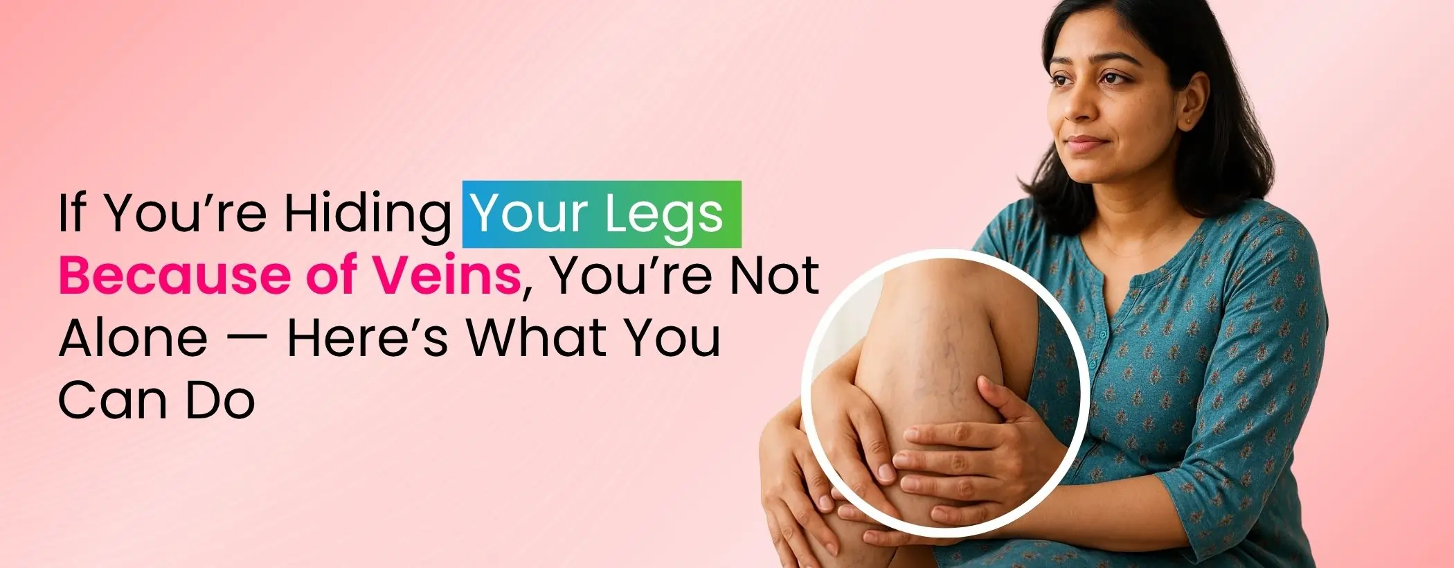 If You’re Hiding Your Legs Because of Veins, You’re Not Alone — Here’s What You Can Do