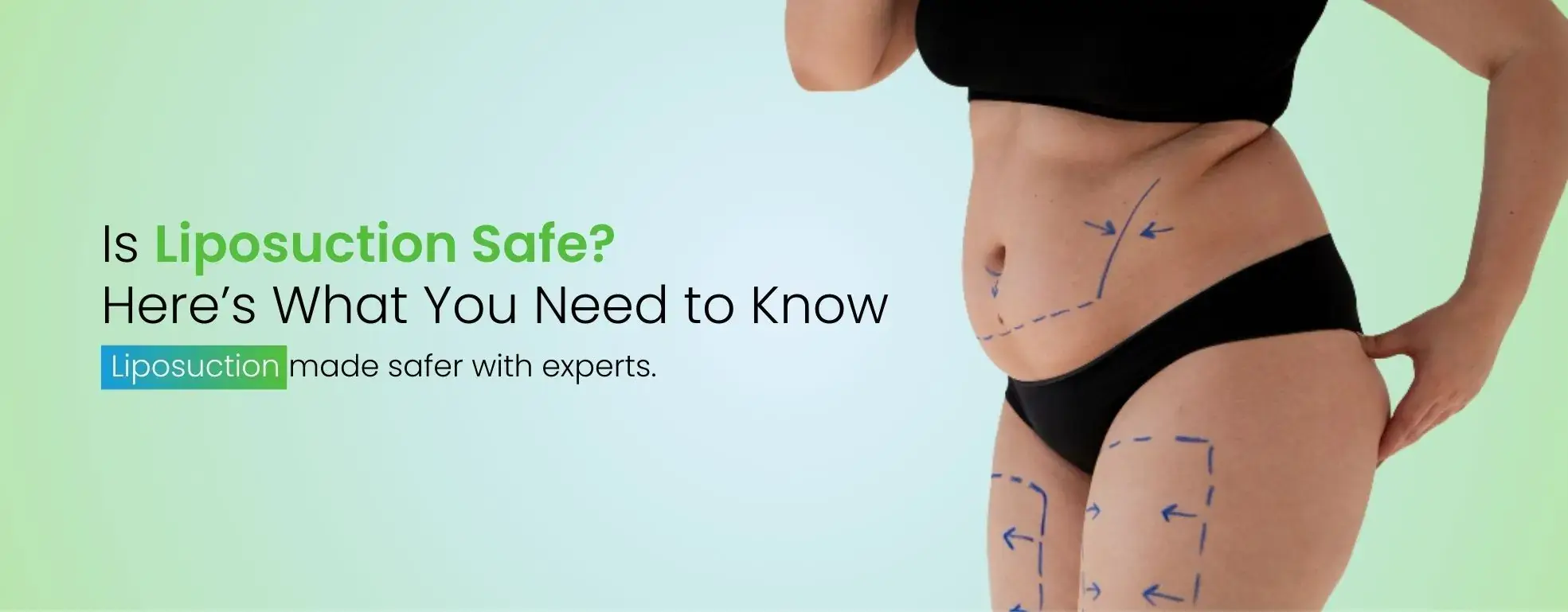 Is Liposuction Safe?