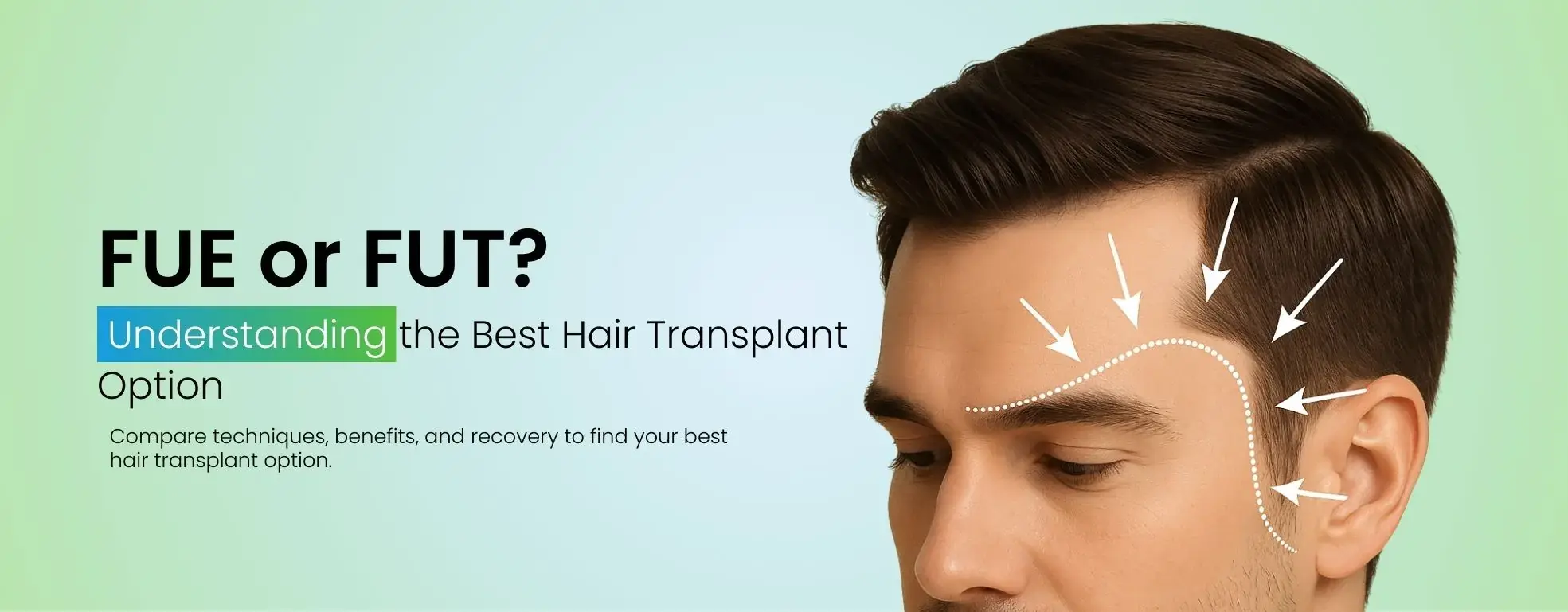 Which Method Is Better, FUE or FUT?