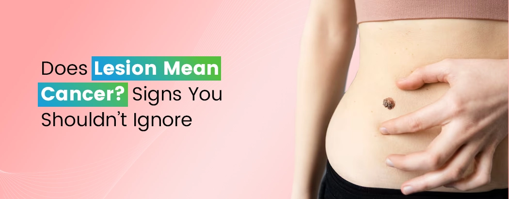 Does Lesion Mean Cancer? Signs You Shouldn’t Ignore