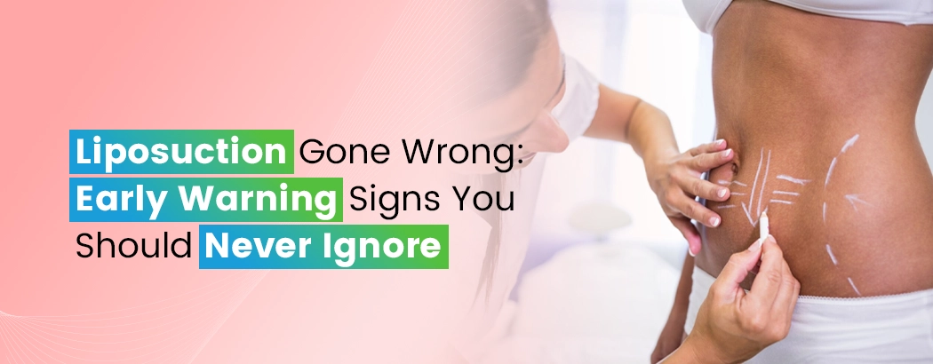 Liposuction Gone Wrong: Early Warning Signs You Should Never Ignore