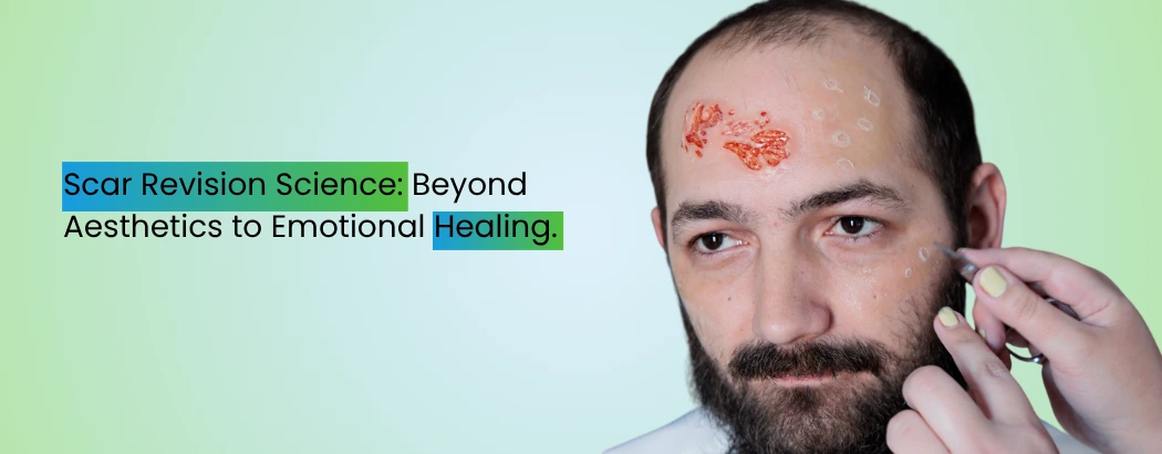 Scar Revision Science: Beyond Aesthetics to Emotional Healing.