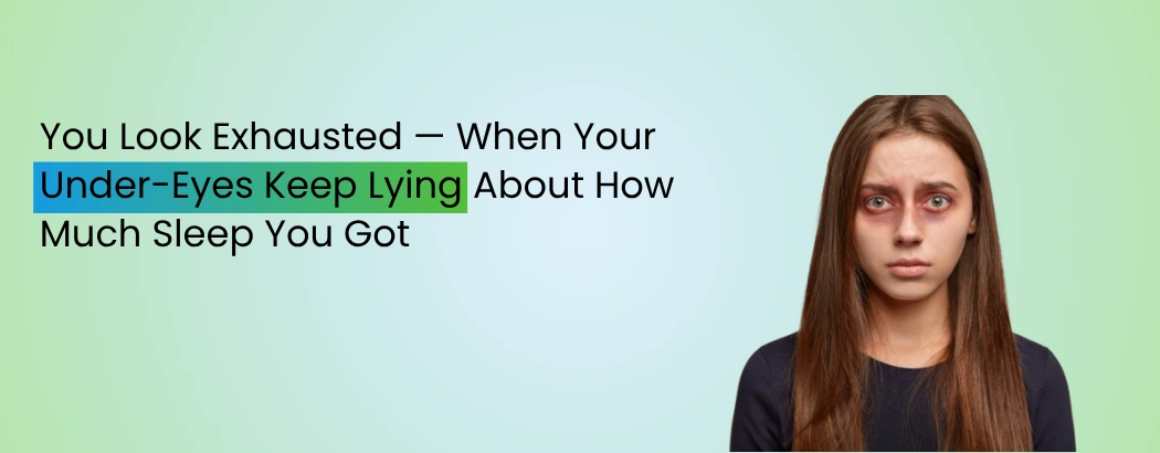 You Look Exhausted — When Your Under-Eyes Keep Lying About How Much Sleep You Got