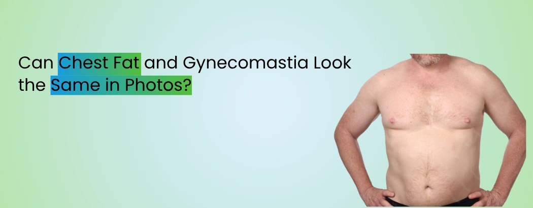 Can Chest Fat and Gynecomastia Look the Same in Photos?